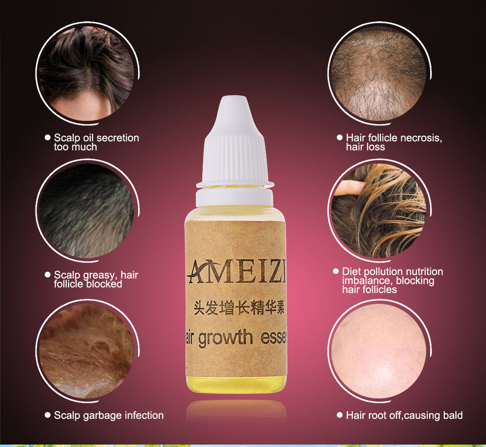 Hair Growth anti Hair Loss Liquid 20ml 0 null